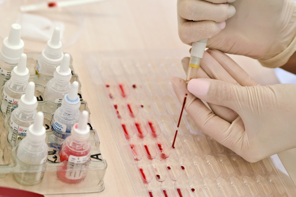 Understanding Blood Type's Impact On Fertility