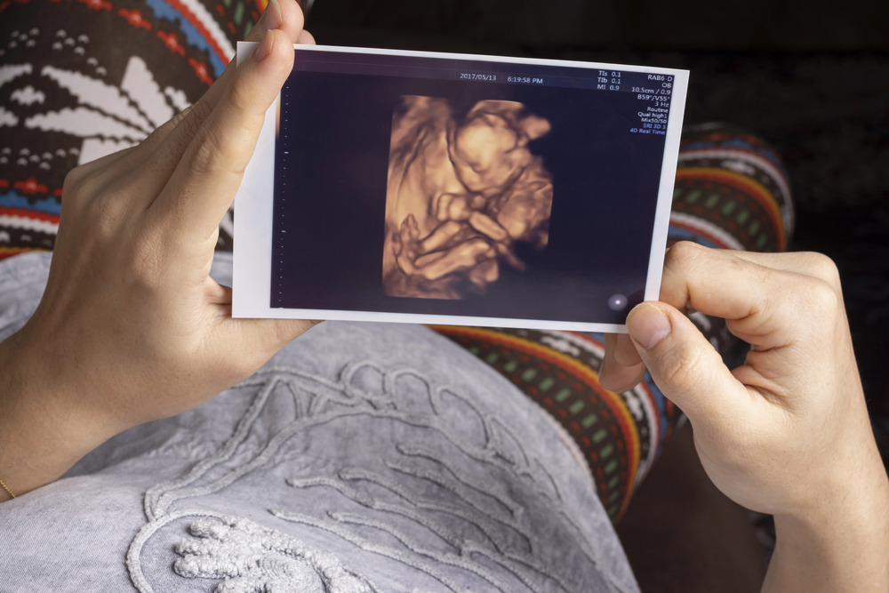 3D and 4D Ultrasounds What They Reveal and Why They Matter